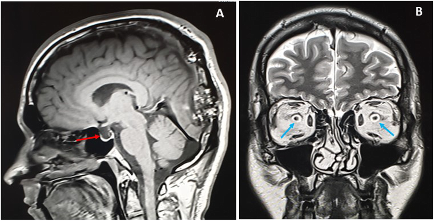 Fig. 9