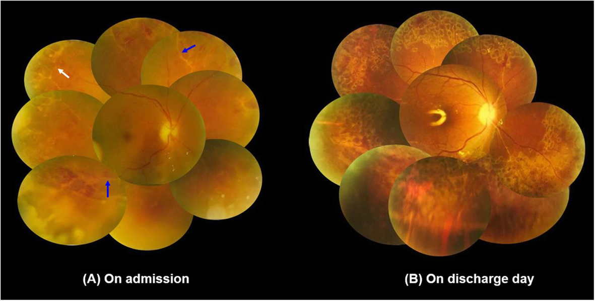 Fig. 1