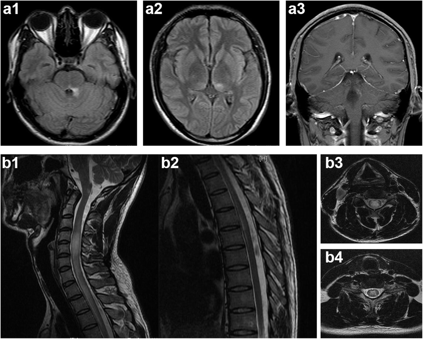 Fig. 1