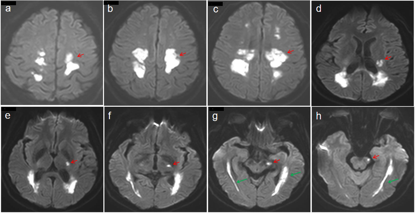 Fig. 2