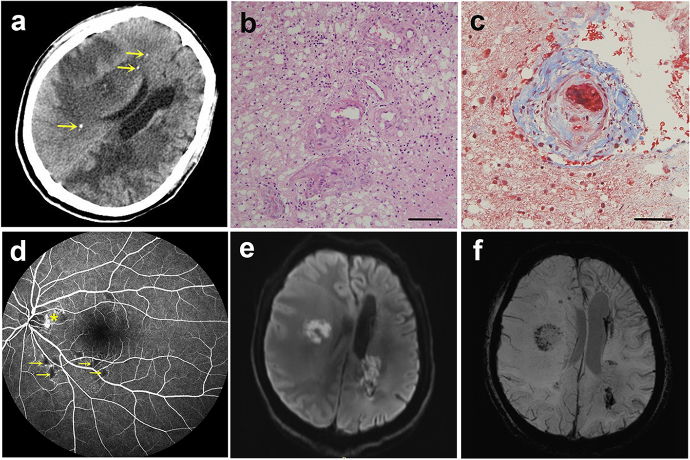 Fig. 2