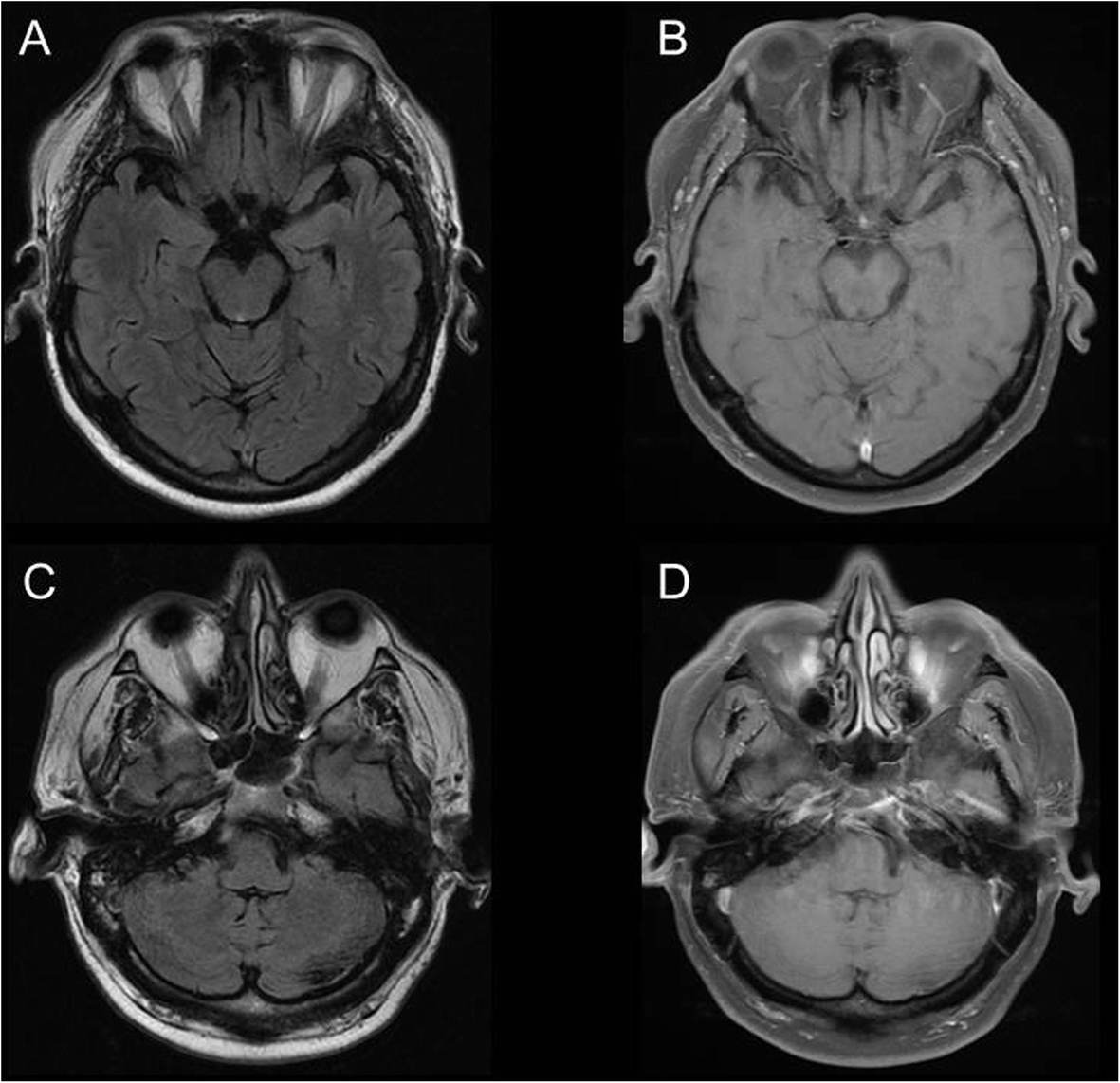 Fig. 4