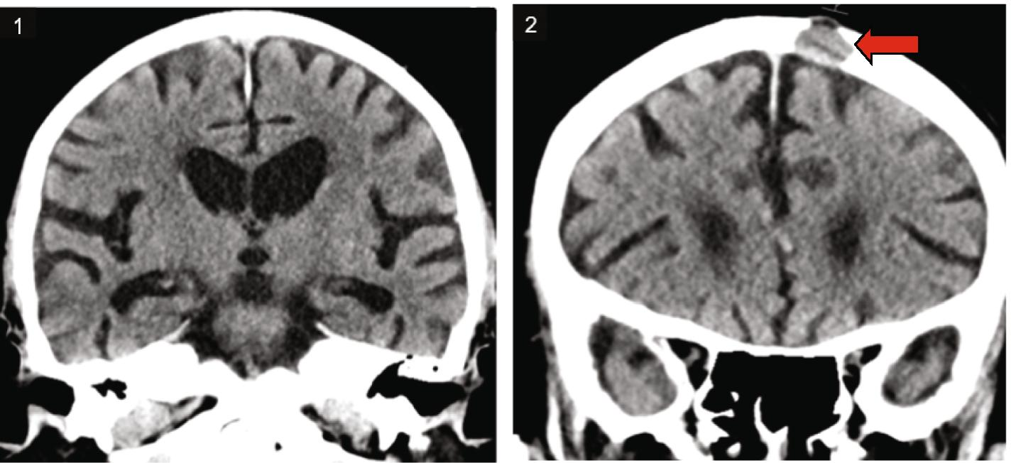 Fig. 1