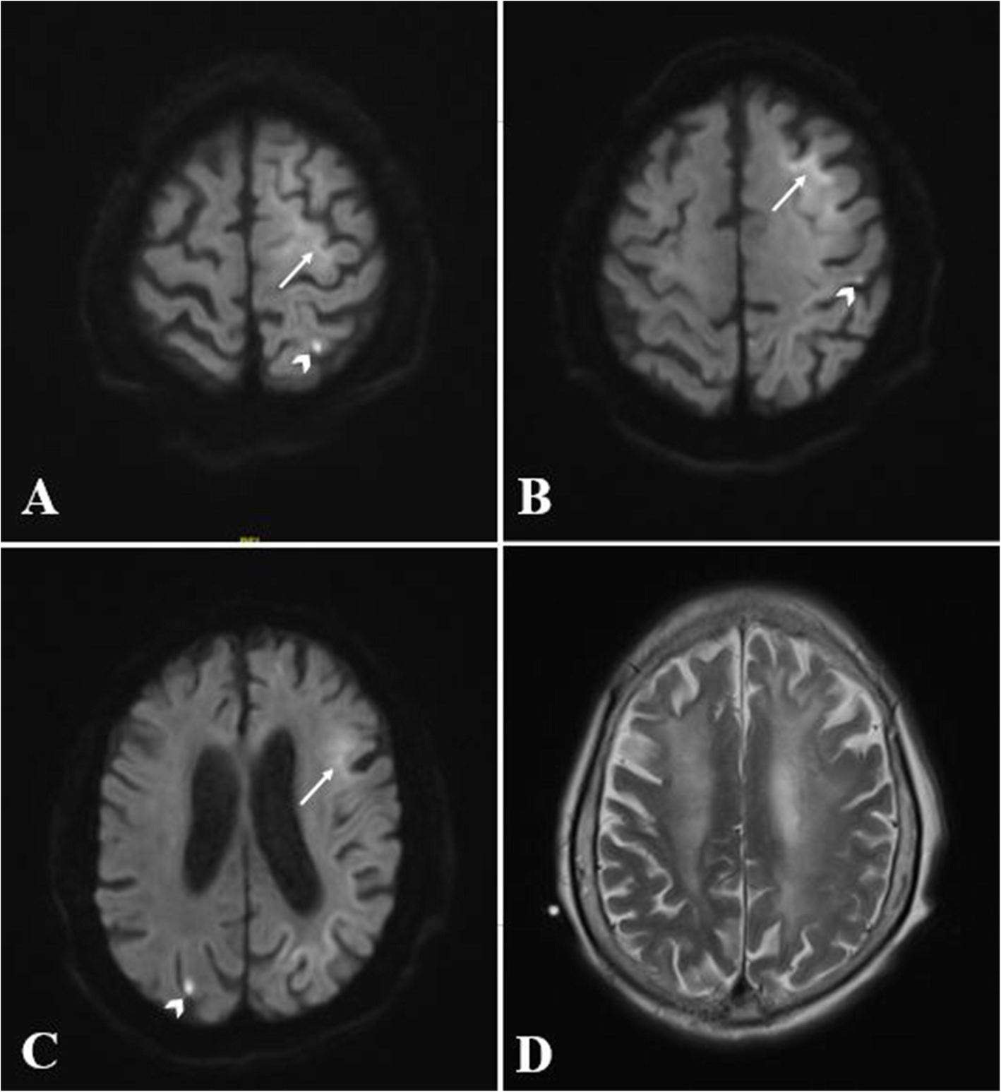 Fig. 1