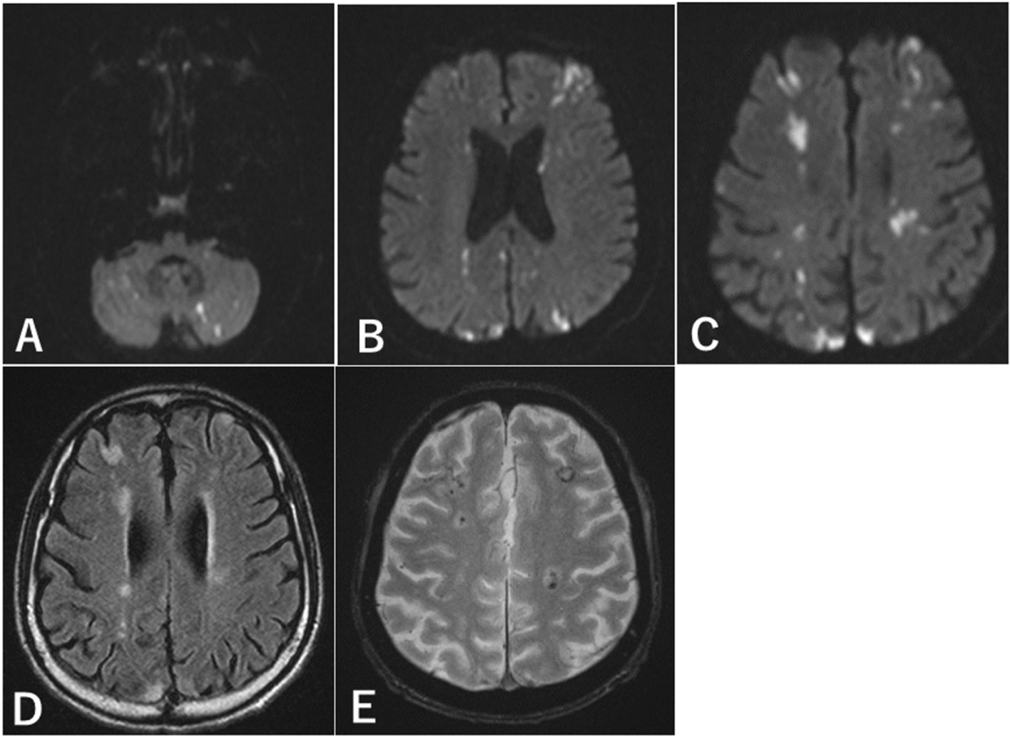 Fig. 1