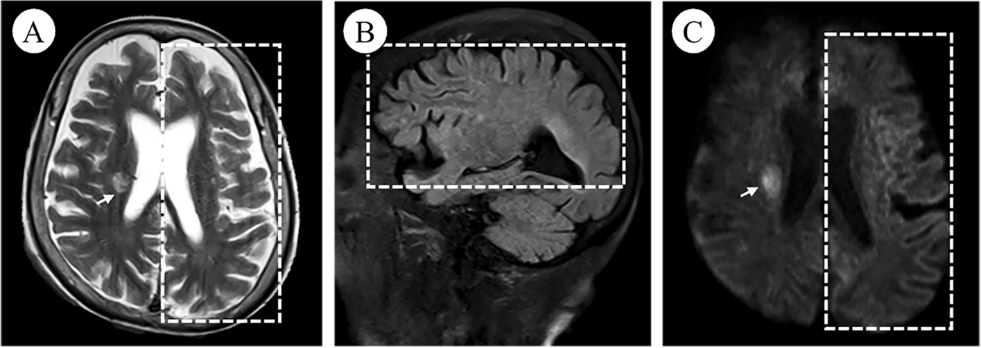 Fig. 2