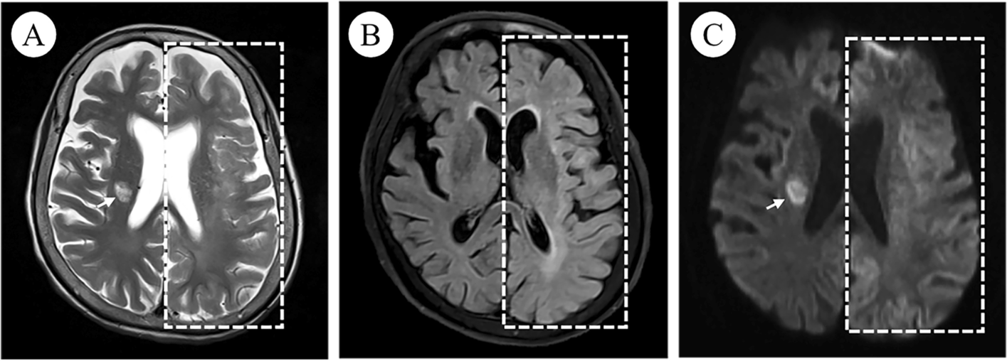 Fig. 4