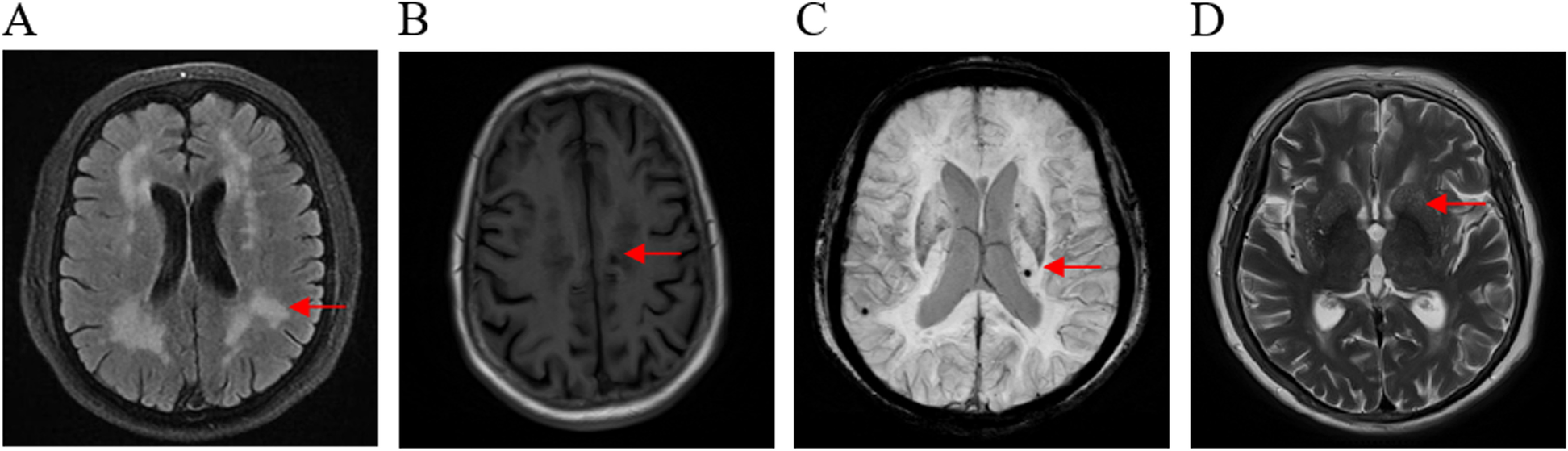 Fig. 2