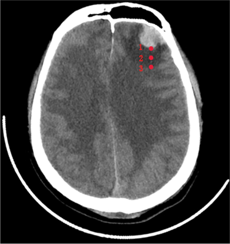 Fig. 4