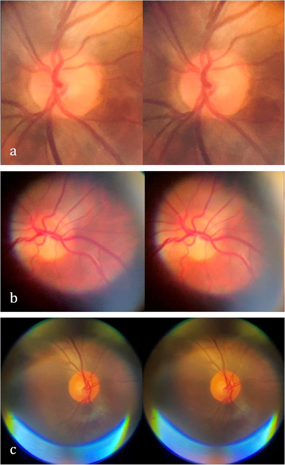 Fig. 3