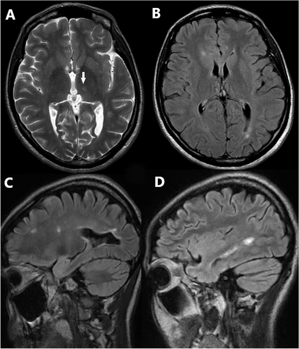 Fig. 2