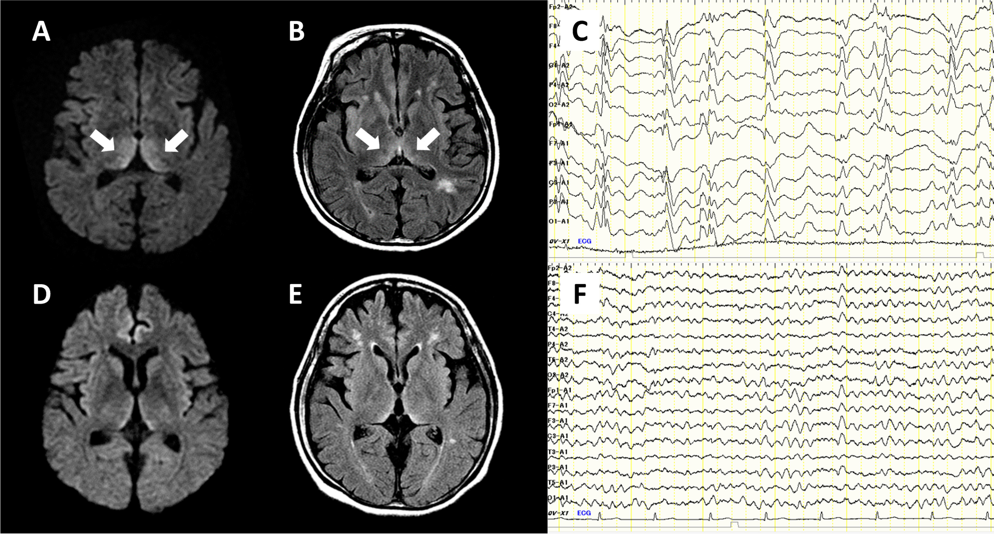 Fig. 2