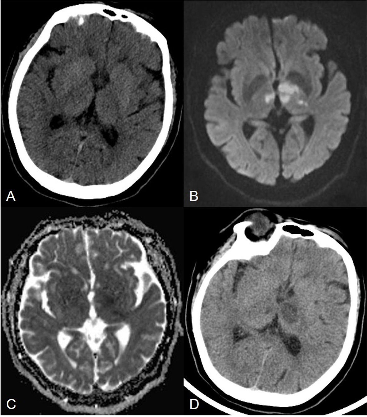 Fig. 4