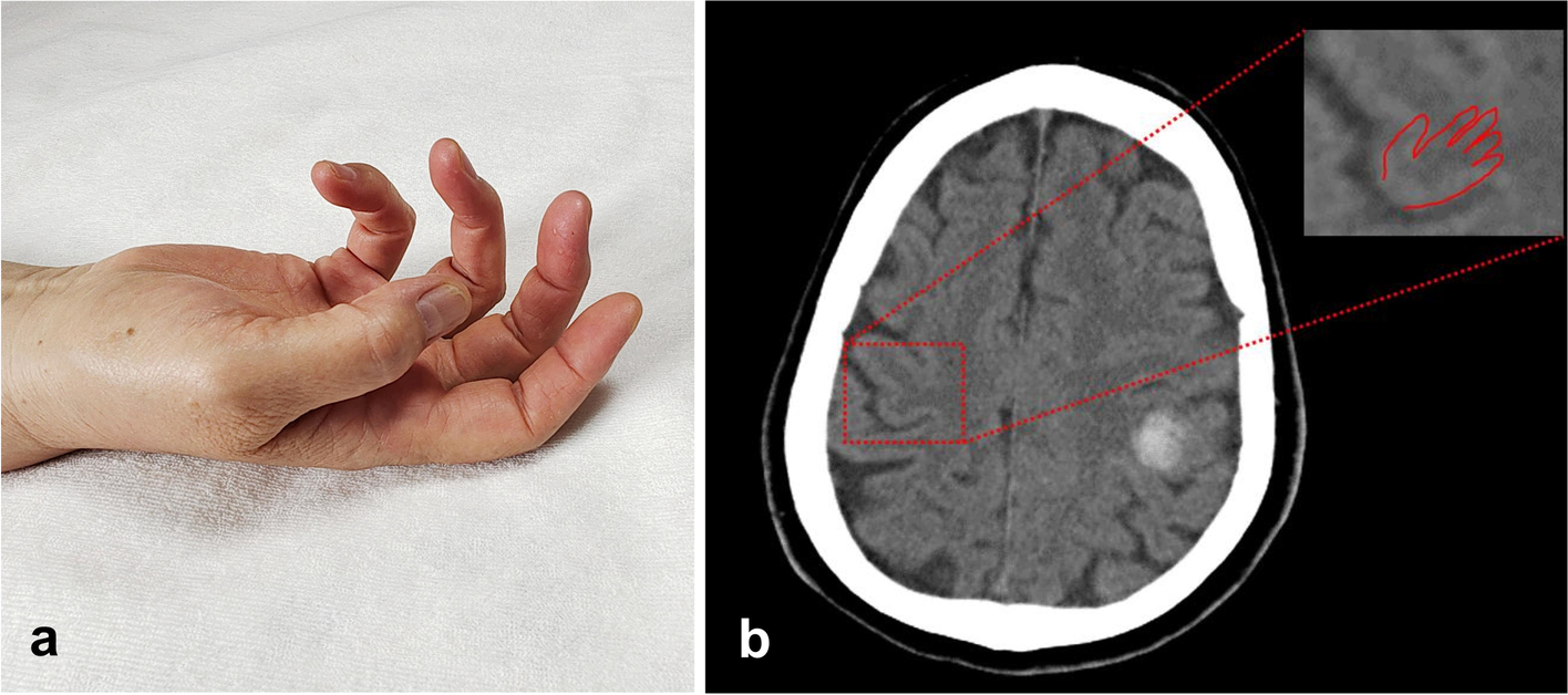 Fig. 1