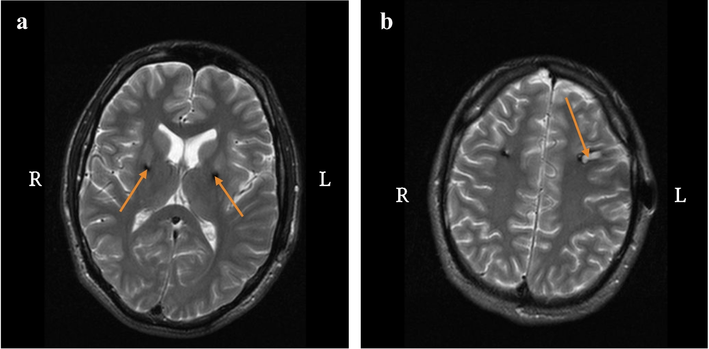 Fig. 5