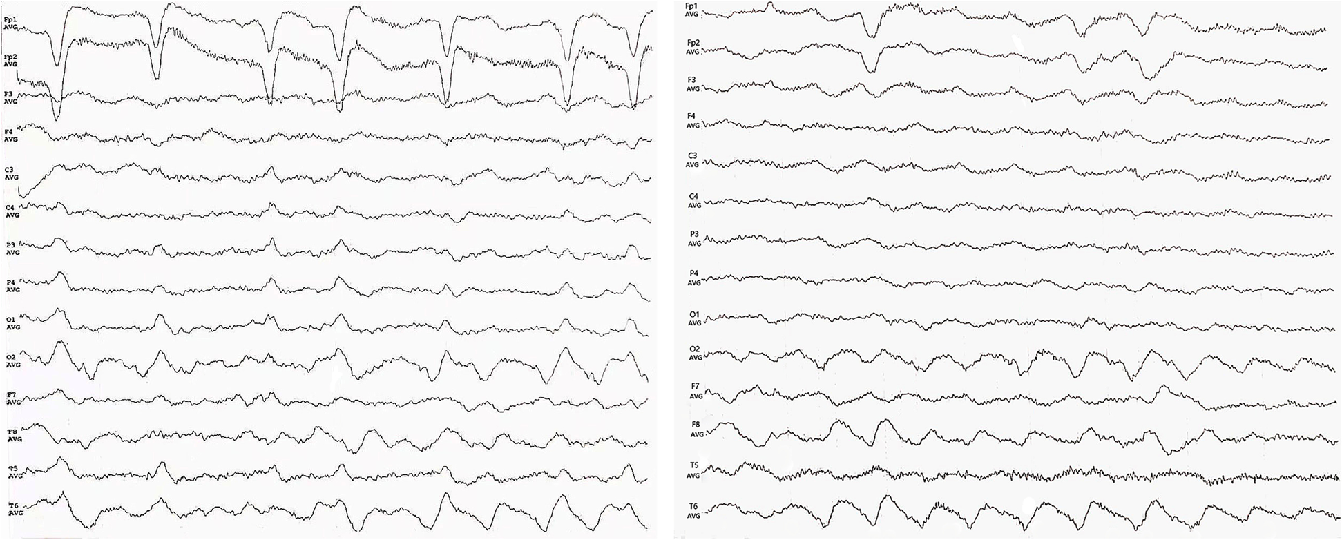 Fig. 4