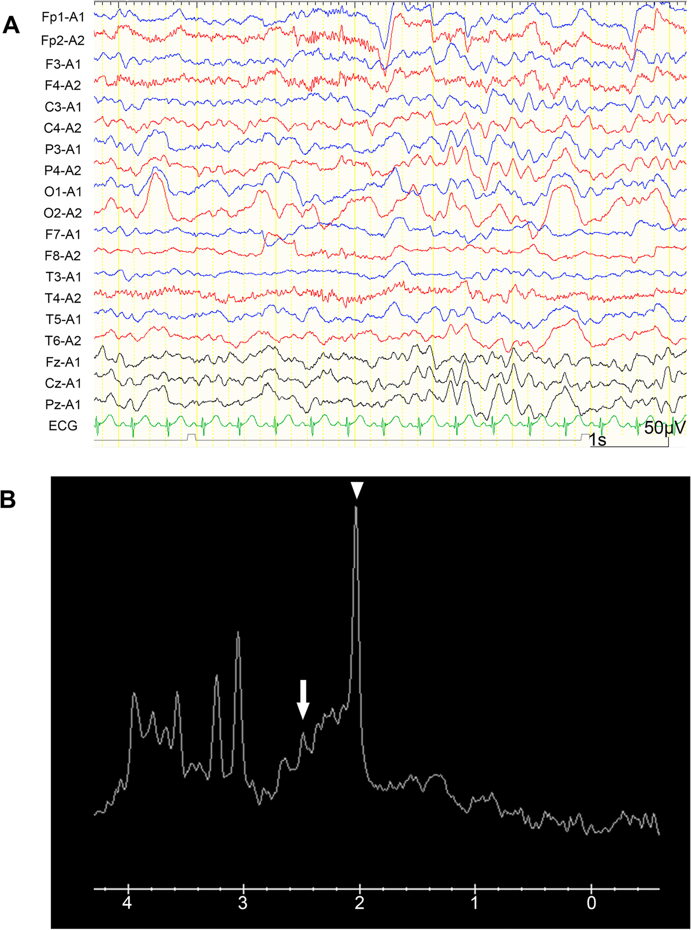 Fig. 3