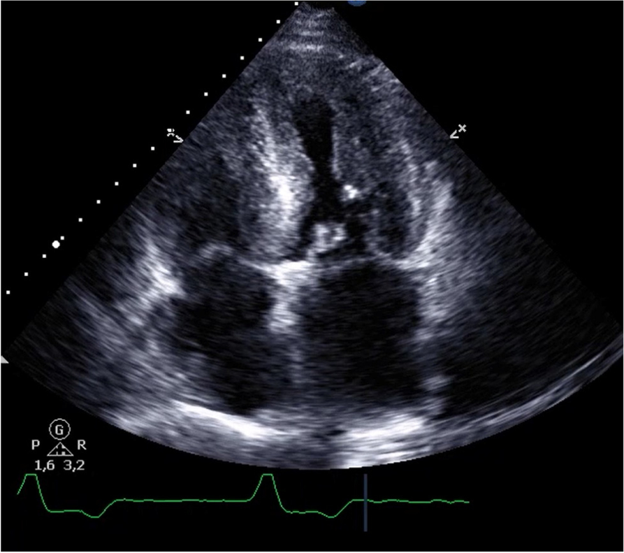 Fig. 1