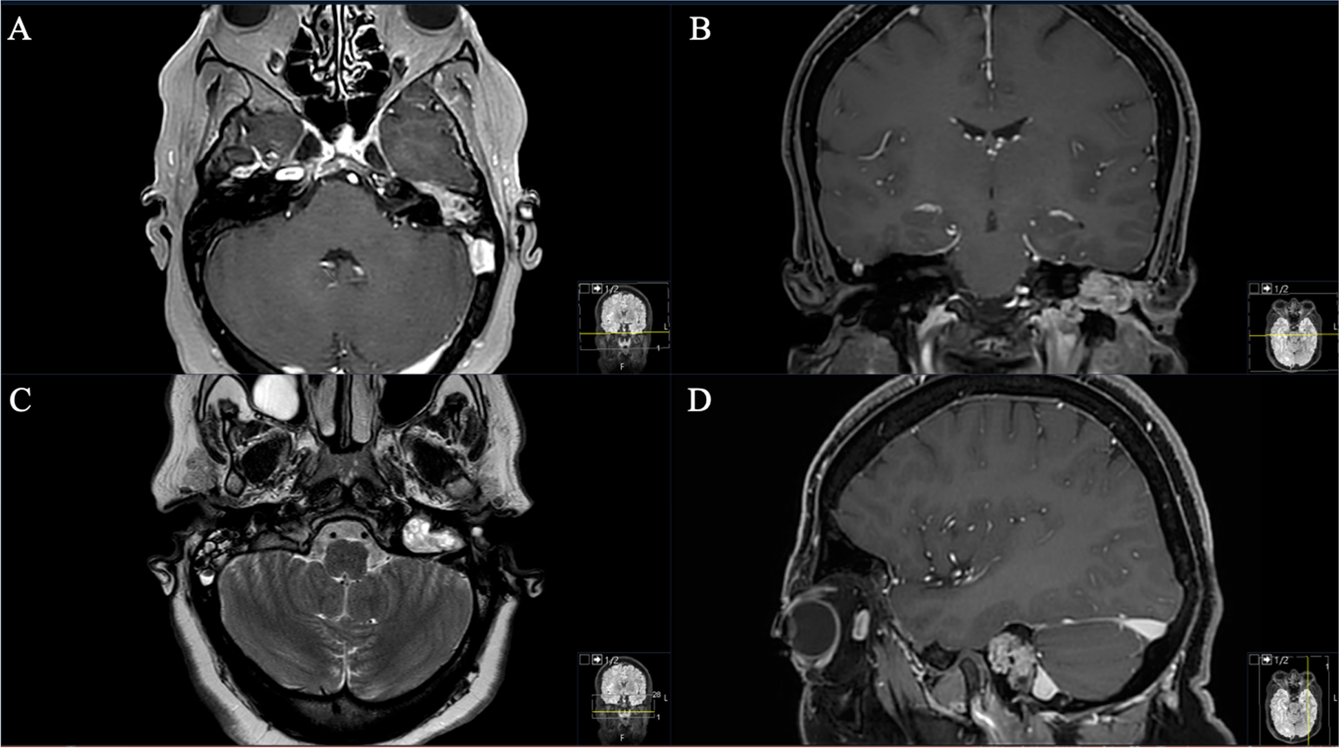 Fig. 2