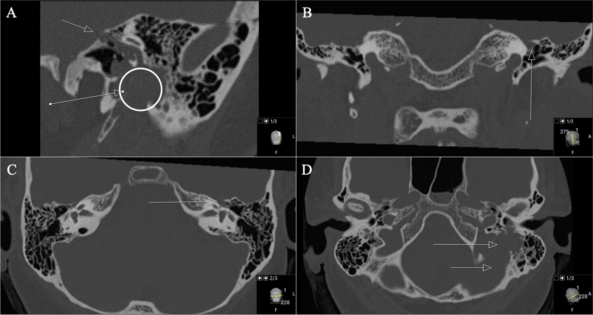 Fig. 9