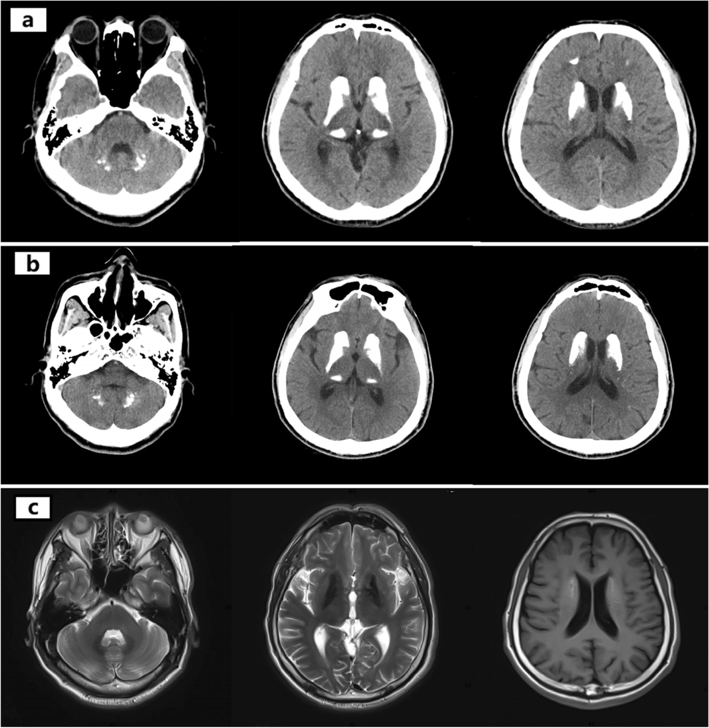 Fig. 1