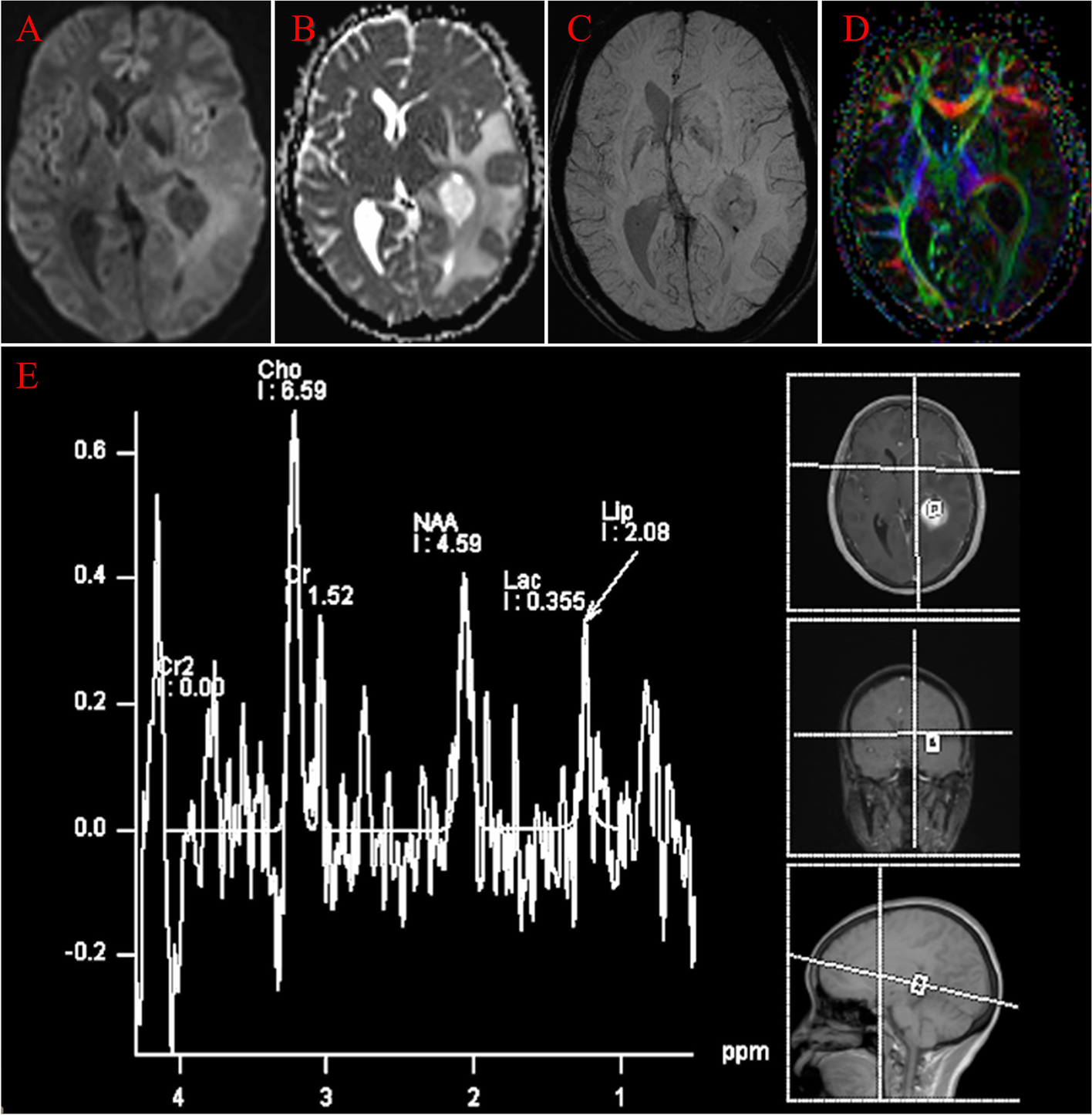 Fig. 2