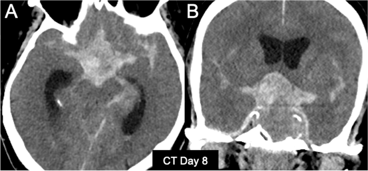 Fig. 4