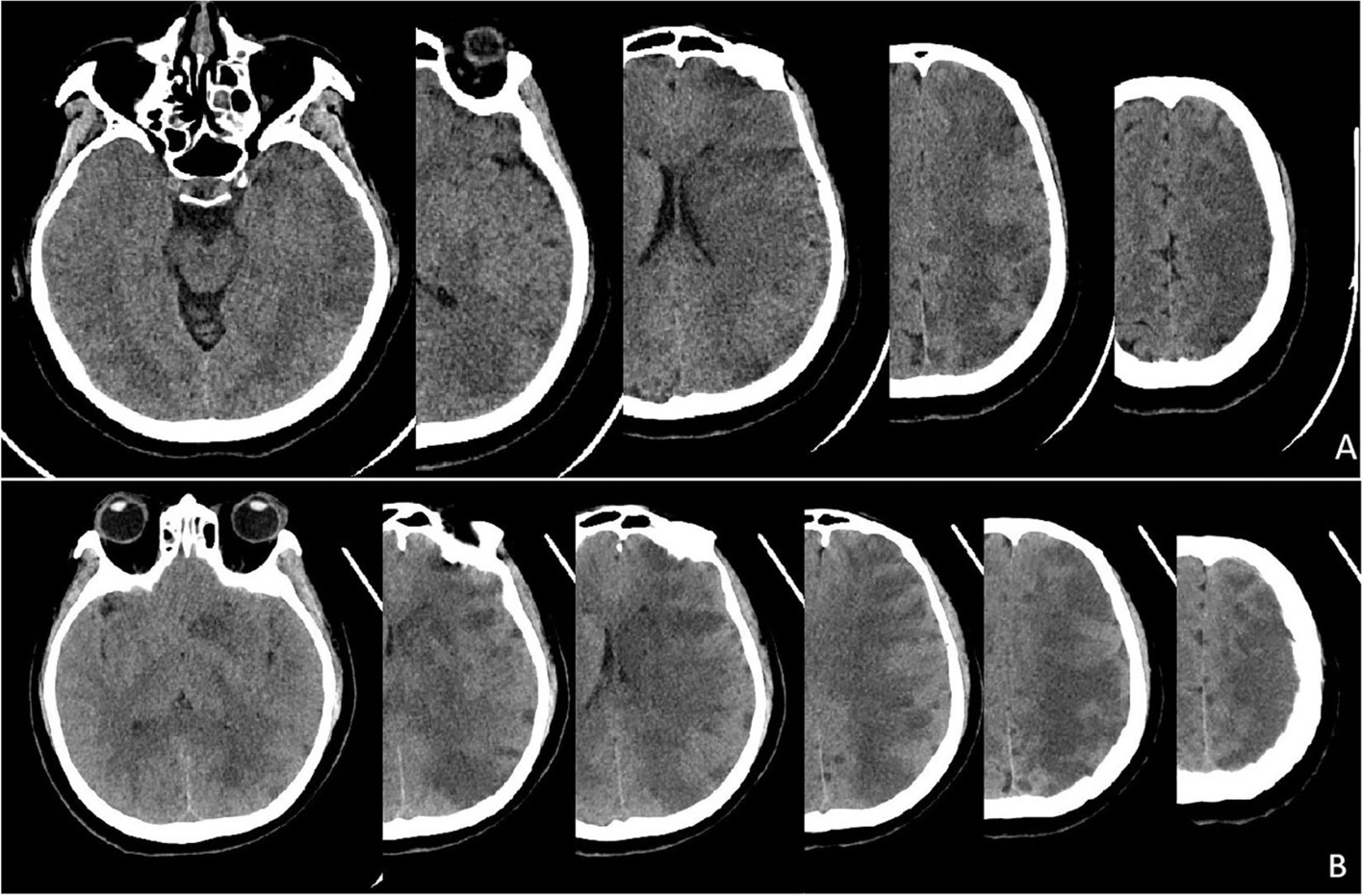 Fig. 4