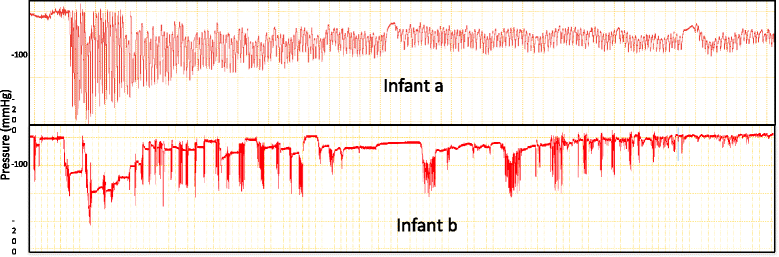 Fig. 5