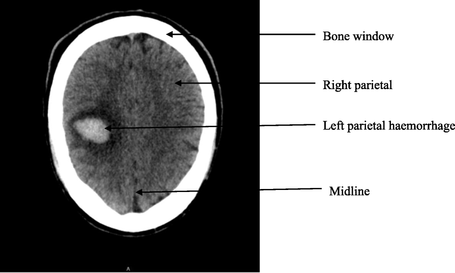 Fig. 1