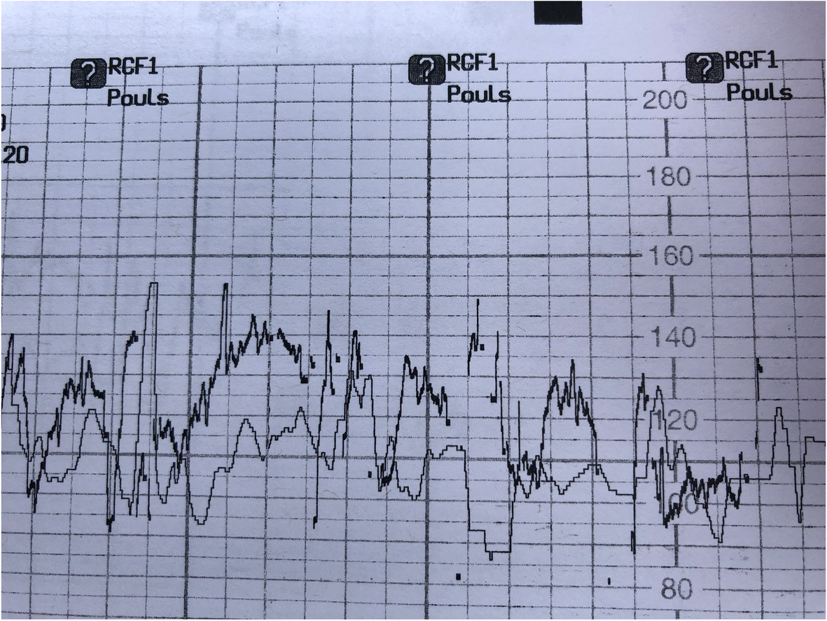 Fig. 1