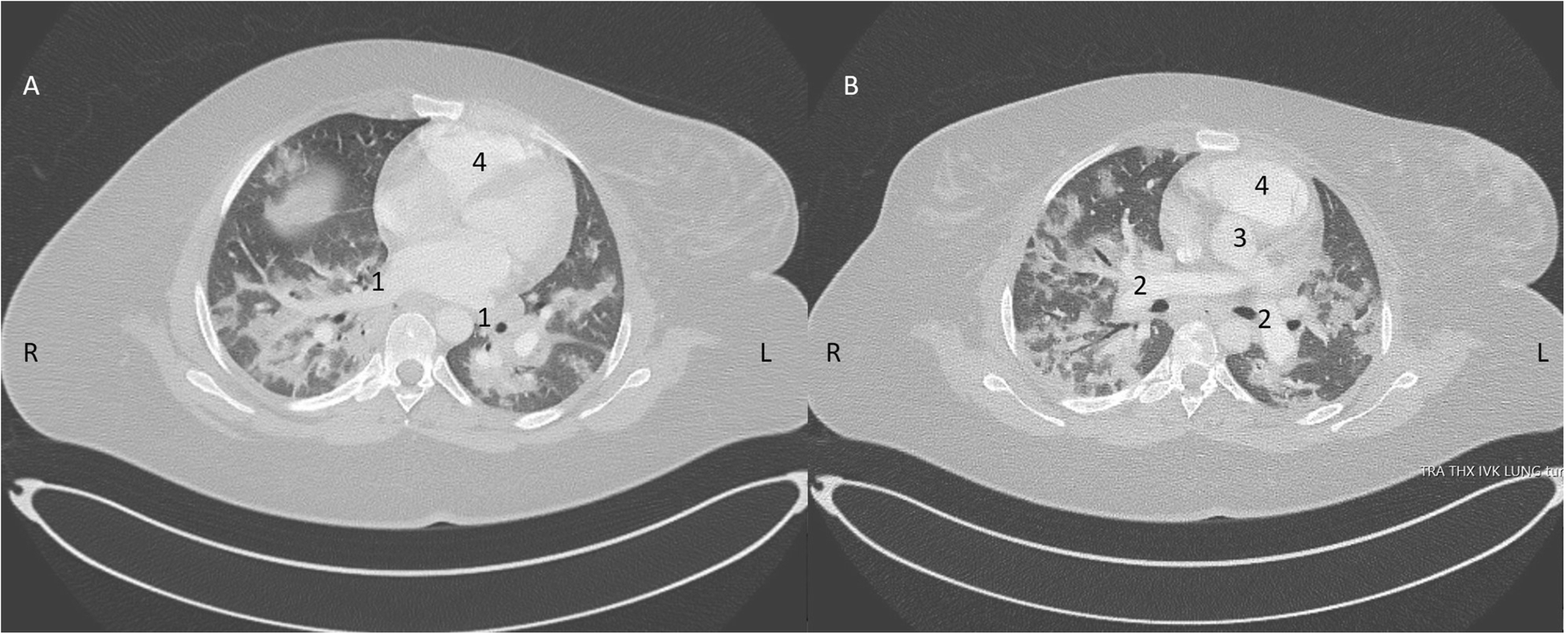 Fig. 2