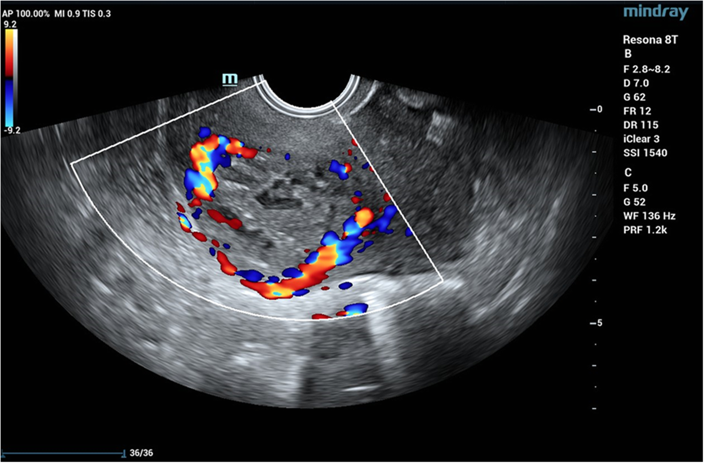 Fig. 2