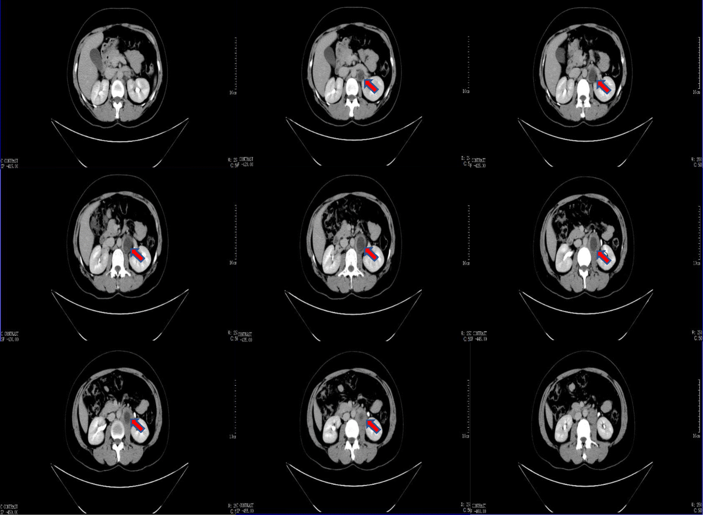 Fig. 4