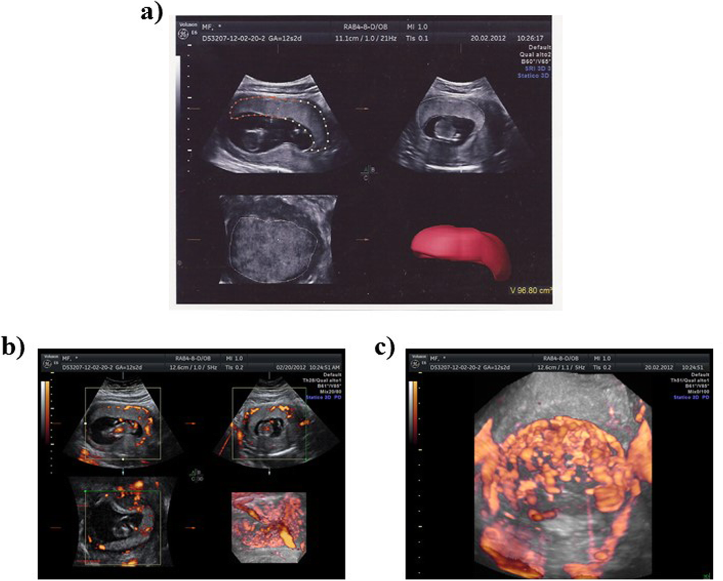 Fig. 1