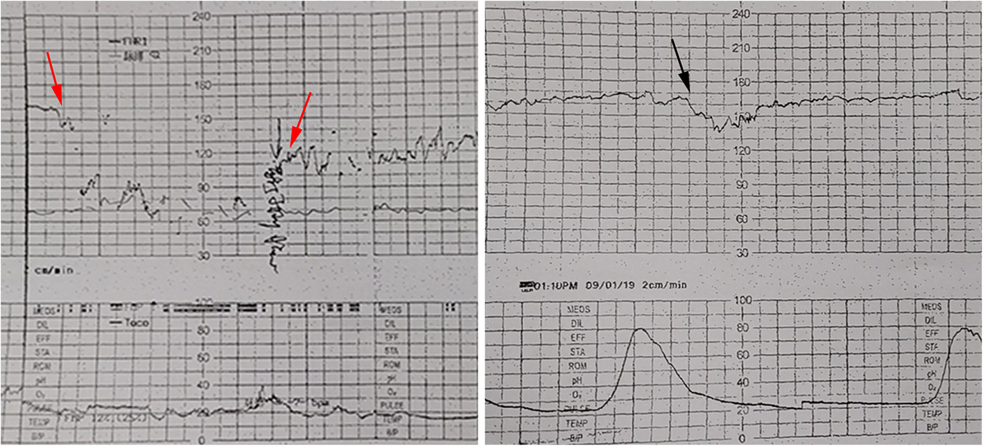 Fig. 2