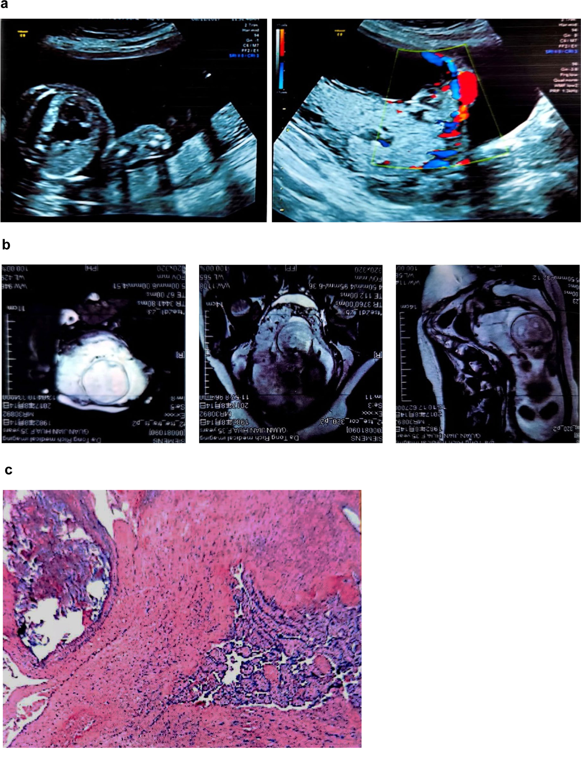 Fig. 4