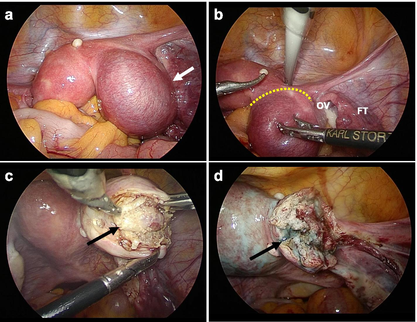 Fig. 4