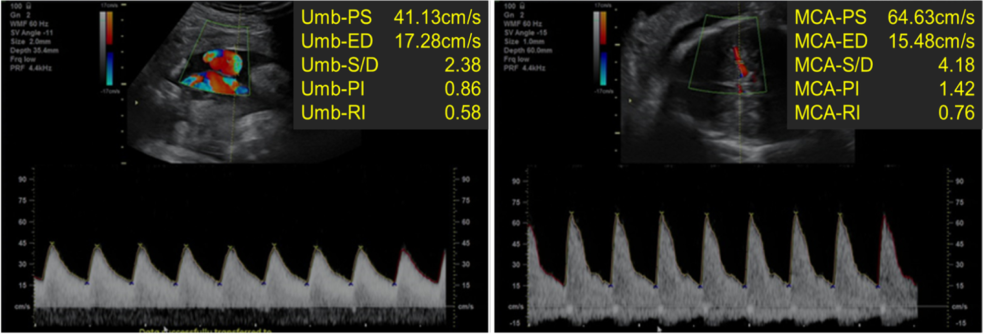 Fig. 2