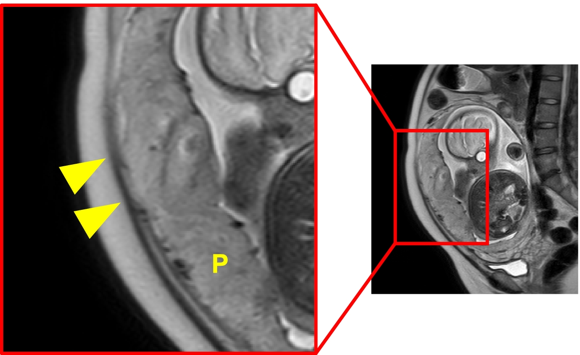 Fig. 5