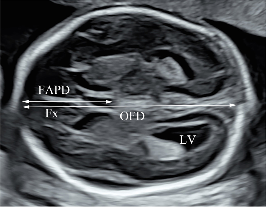 Fig. 1