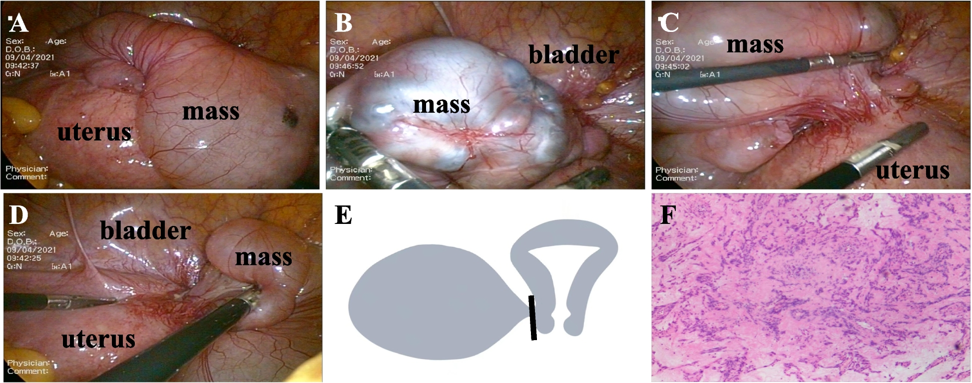 Fig. 2