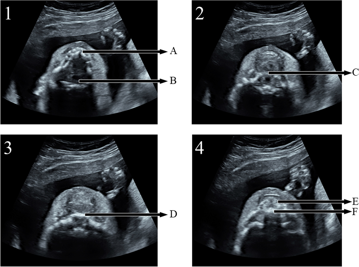 Fig. 4