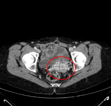 Fig. 3