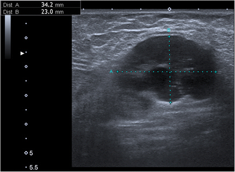 Fig. 5