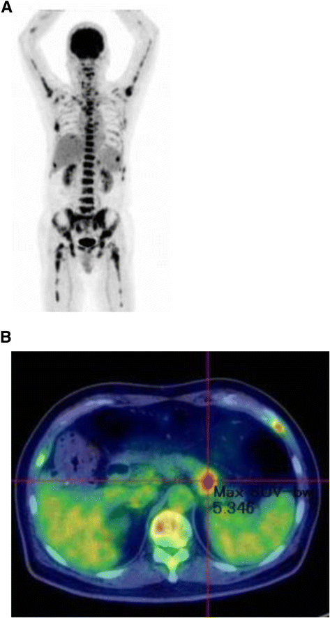 Fig. 3