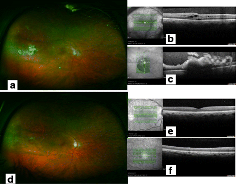 Fig. 1