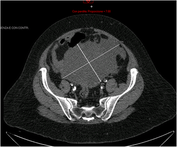 Fig. 1