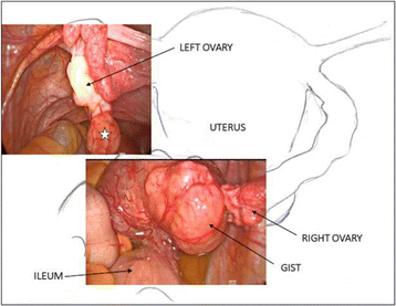 Fig 3