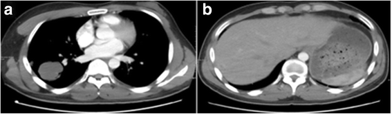 Fig. 14